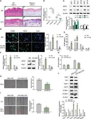 Diabetic macrophage small extracellular vesicles-associated miR-503/IGF1R axis regulates endothelial cell function and affects wound healing
